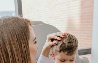 Qué es la alopecia areata y cómo prevenirla