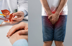 Factor oculto que impulsa el cáncer de próstata agresivo, según Mayo Clinic