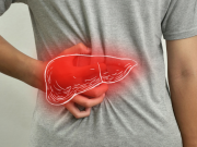 Identifican una proteína como posible diana terapéutica para prevenir el graso
