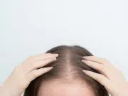 Alopecia femenina: la enfermedad silenciosa que muchas mujeres ocultan bajo pelucas y extensiones