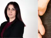 Aranzazu Gallego, pediatra: ‘Es falso que los piojos saltan de cabeza a cabeza, lo de cortar el pelo como solución es innecesario’