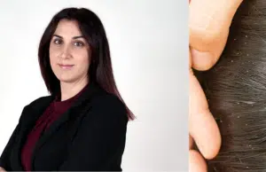 Aranzazu Gallego, pediatra: ‘Es falso que los piojos saltan de cabeza a cabeza, lo de cortar el pelo como solución es innecesario’