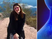 Parecía que esta mujer tenía una pelota de tenis en el cuello, meses después, fue diagnosticada con cáncer: tenía sudoración y calores nocturnos