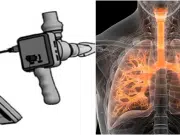 Innovación colombiana: Universidad del Rosario patenta dispositivo que mide la fuerza de los músculos respiratorios
