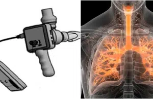 Innovación colombiana: Universidad del Rosario patenta dispositivo que mide la fuerza de los músculos respiratorios