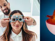 Ocho de cada diez problemas de visión podrían prevenirse con revisiones periódicas, según los expertos