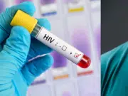 ¿Dolor de garganta es un síntoma temprano del VIH? Clínica Mayo explica si tiene relación con la carga viral inicial