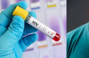 ¿Dolor de garganta es un síntoma temprano del VIH? Clínica Mayo explica si tiene relación con la carga viral inicial