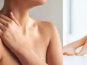 Picores de sarna: ¿qué es y cómo prevenir esta enfermedad de la piel?