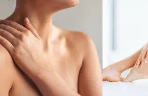 Picores de sarna: ¿qué es y cómo prevenir esta enfermedad de la piel?