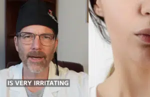 Cirujano explica por qué nunca hay que poner la cabeza hacia atrás cuando hay sangrado nasal: ‘Por la garganta hacia el estómago’