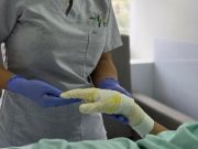 San Vicente Fundación recibió mención en atención de quemaduras