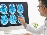 Nueva herramienta estima el riesgo de Alzheimer hasta diez años antes de los primeros síntomas