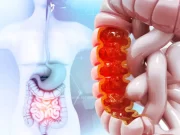 Así funciona el dispositivo creado en Medellín que puede ayudar a detectar el cáncer de colon en minutos