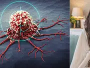 El común síntoma que podría confundirse con gripa y que puede ser señal de un cáncer: ‘Si la tos dura más de tres semana, consulte al médico’