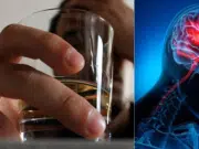 Beber en exceso puede adelantar un ataque cerebrovascular más de 10 años y dificultar la recuperación, según estudio de Harvard