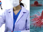 Un simple análisis de sangre podría detectar el cáncer en etapas tempranas y mejorar la supervivencia, según Harvard