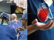 Así fue como implantaron dos corazones artificiales en un mismo día por primera vez en Colombia