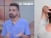 Especialista en cirugía capilar advierte que la pérdida de cabello puede ser síntoma de enfermedades hormonales, autoinmunes o nutricionales