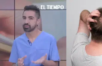 Especialista en cirugía capilar advierte que la pérdida de cabello puede ser síntoma de enfermedades hormonales, autoinmunes o nutricionales