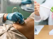 Cáncer de pancreas: síntomas de alerta que pueden dar una detección y cura de forma temprana