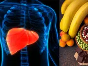 Hígado graso: este es el mineral que debe consumir para reducir porcentaje de grasa en el órgano