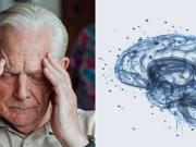 Científicos encuentran en la estimulación magnética cerebral una nueva forma de combatir la demencia