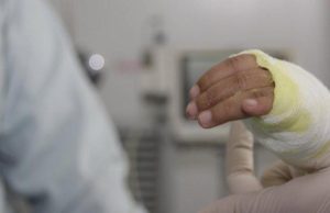 No solo es pólvora, las otros factores de riesgo en casa que también pueden generar quemaduras en niños durante diciembre