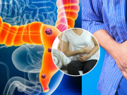 Estas son las respuestas a las dudas esenciales sobre los norovirus: los médicos derrumban los mitos