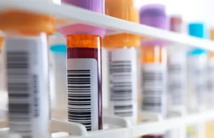 Vivir con VIH en Colombia: avances médicos amplían el horizonte de bienestar y calidad de vida