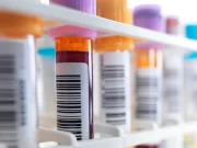 Llegó a Colombia ‘VIH: La Causa Justa’, un documental que invita a actuar contra el estigma del virus en América Latina