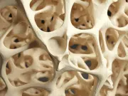 Científicos identificaron un nuevo ‘interruptor’ molecular que podría transformar el tratamiento de la osteoporosis