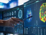 Experto advierte que el sedentarismo y los alimentos ultraprocesados disparan el riesgo de accidente cerebrovascular