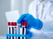 Investigación identifica un extraño fenotipo híbrido en solo tres personas entre 544.000 muestras