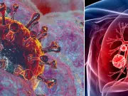 Estas mujeres descubrieron que tenían cáncer de pulmón a pesar de no ser fumadoras, una situación cada vez más común en Estados Unidos