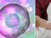 Consiguen eliminar el VIH de un paciente de leucemia con un trasplante de células madre: así fue como lo lograron