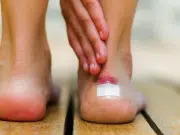 Ampollas en los pies: ¿cómo curarlas y evitar que salgan más?