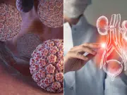 Un virus adquirido en la niñez y silencioso durante años podría provocar cáncer de vejiga, según estudio