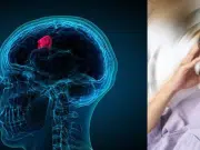 Seis síntomas que pueden indicar un tumor cerebral y que muchos pasan por alto