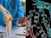 Científicos identifican proteína que destruye el cartílago en la artrosis y hallan forma de regenerarlo