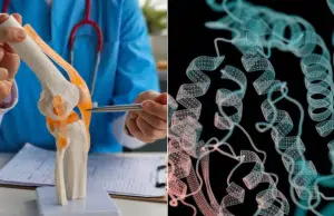 Científicos identifican proteína que destruye el cartílago en la artrosis y hallan forma de regenerarlo