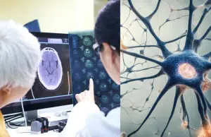Eliminar una proteína podría reducir el daño cerebral por el Alzheimer, según nueva estrategia científica probada en laboratorio