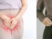 ¿Por qué comienza a doler la vagina entre los 40 y 50 años? ‘Es un problema hormonal que tiene remedio’