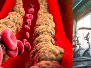 Los ejercicios más eficientes para bajar el colesterol, según la Clínica Mayo