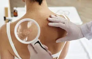 El viacrucis de los pacientes de cáncer por la crisis del sistema de salud