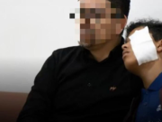 Reportan 53 personas quemadas por pólvora en Bogotá: 12 son niños