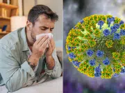 La ‘supergripa’ que preocupa a expertos y que estaría en todo el país: alertan por aumento de enfermedades respiratorias