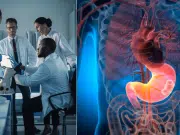 Nuevo estudio descubre una bacteria que podría favorecer el desarrollo del cáncer de estómago