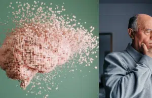 No toda pérdida de memoria indica Alzheimer: neurólogo explicó las diferencias
