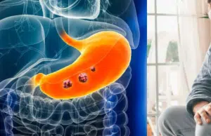 ¿Cuáles son los primeros síntomas del cáncer de estómago, según la Clínica Mayo?